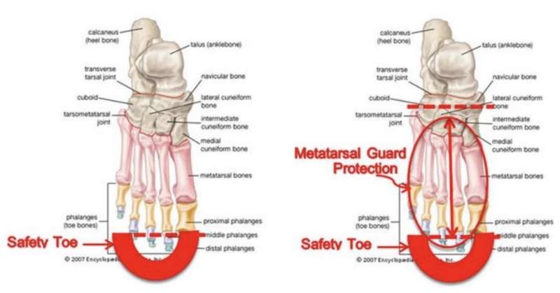 Toes vs Metatarsal Bones